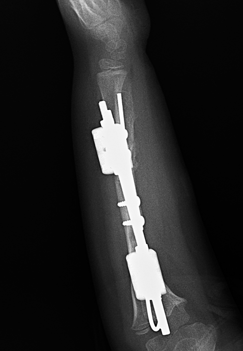 Image Alt