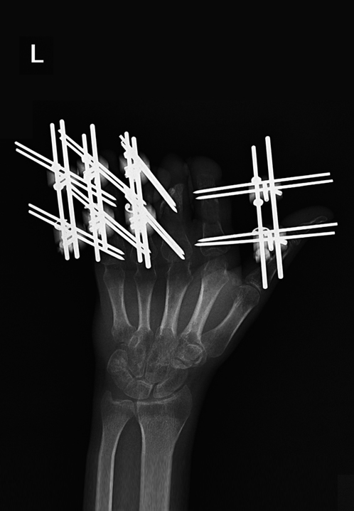 Image Alt
